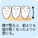 鏡で見ると、前よりも歯が長くなったように感じる。